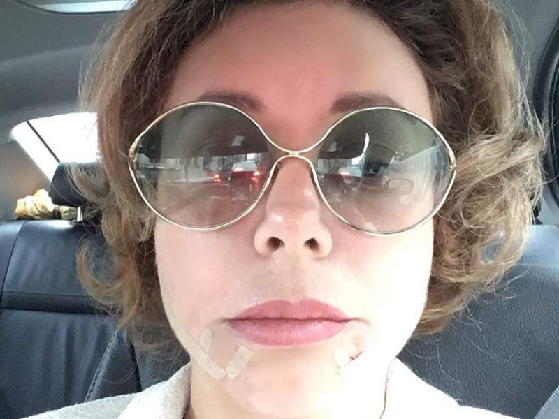 Новости дня: "Лицо поехало": 44-летняя Божена Рынска перекроила себя ради селфи